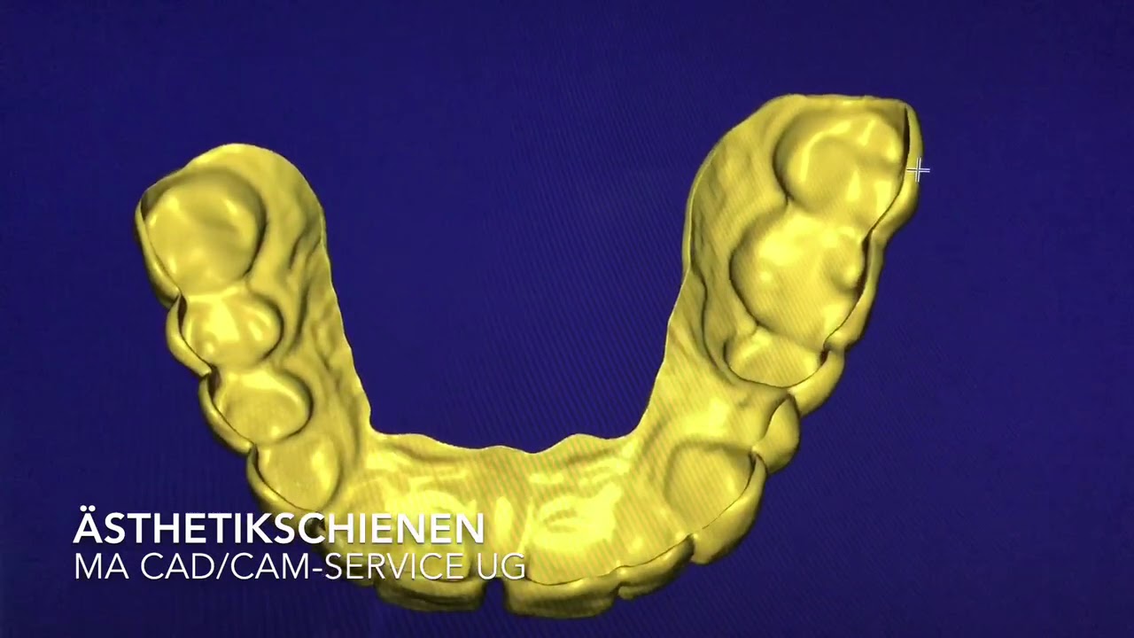 ÄSTHETIKSCHIENEN