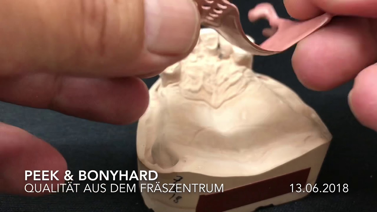 PEEK & Bonyhardklammern