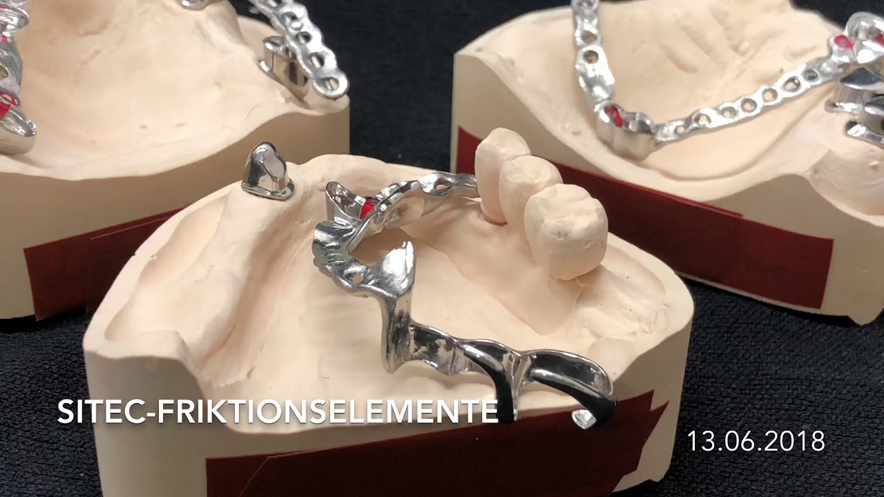 Si-Tec Friktionselemente