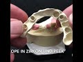 Konuskop Zirkon & PEEK