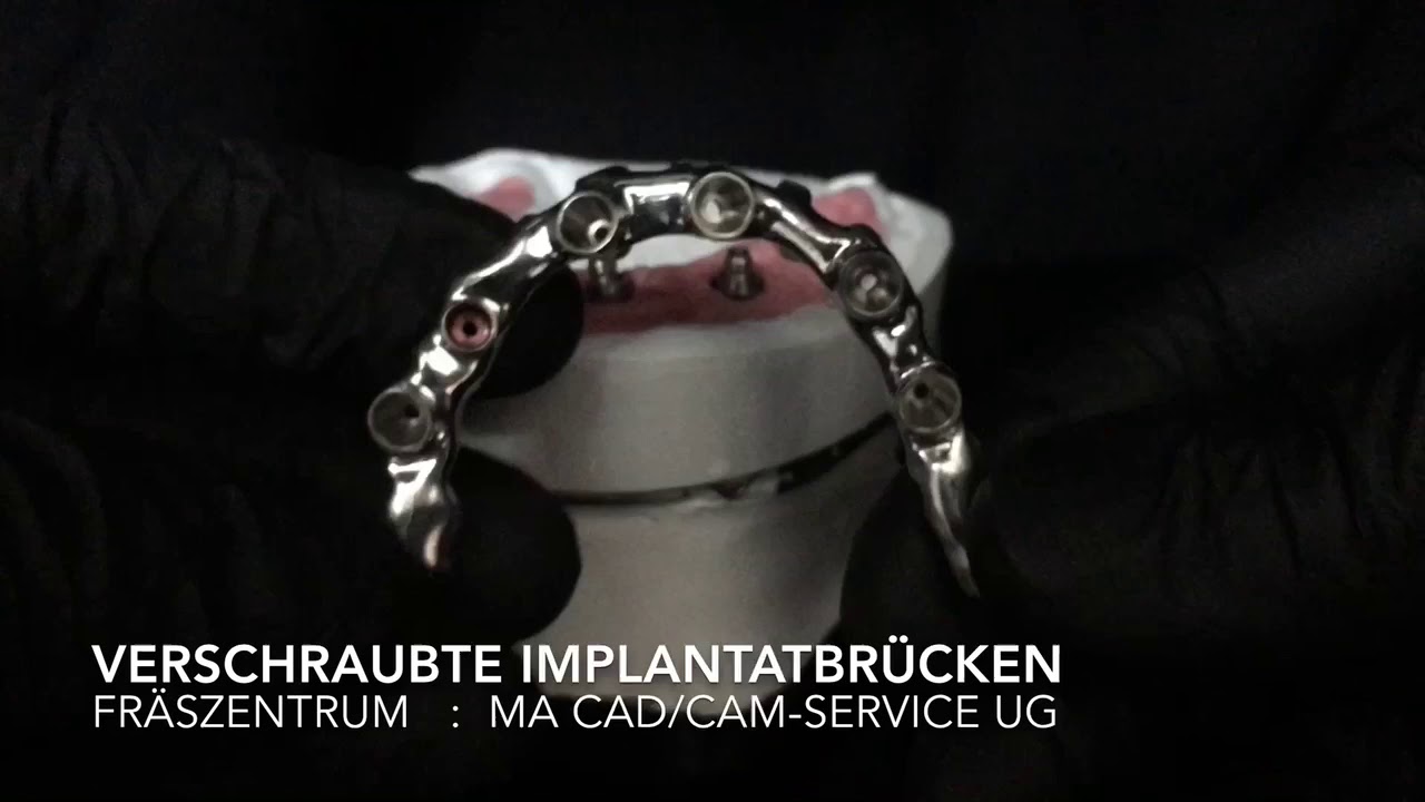 Gefräste Implantatbrücken