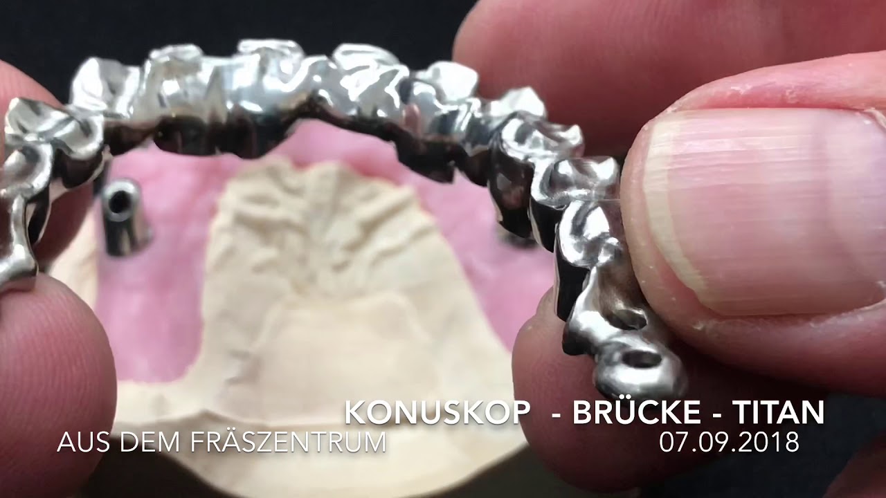 Konuskop TITAN