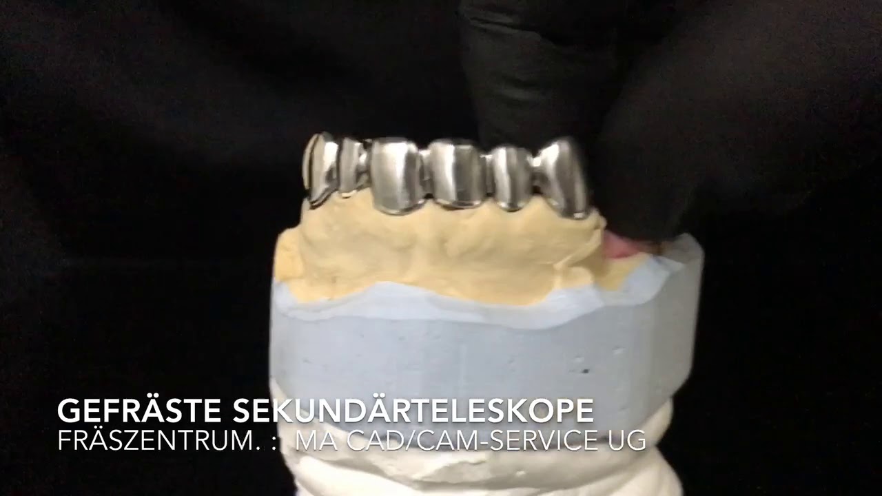 Gefräste Sekundärteleskope mit Retentionen